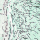 Aspergillose : maladie respiratoire