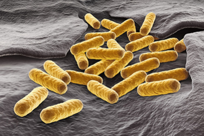 Colibacillose : maladie digestive infectieuse