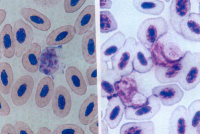 Atoxoplasmose ou Lankesterella